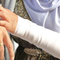 What Are the Most Common Burn Injuries in the Workplace?