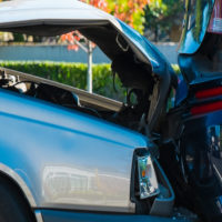 What Happens if I am Knocked Unconscious in a Car Accident?