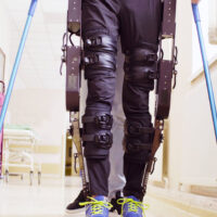 What Are the Common Types of Leg Injuries Caused by Car Accidents?